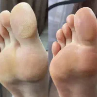 پدیکور و کفسابی-کاشت و ترمیم و ژلیش-لمینت|خدمات آرایشگری و زیبایی|کرج, اتحاد|دیوار