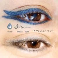 میکروبلیدینگ و ریموو حرفه‌ای|خدمات آرایشگری و زیبایی|اهواز, زیتون کارمندی|دیوار