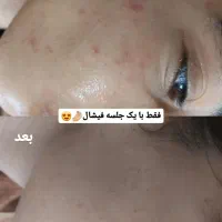 فیشال تخصصی پوست|خدمات آرایشگری و زیبایی|محمدشهر, محمدشهر|دیوار