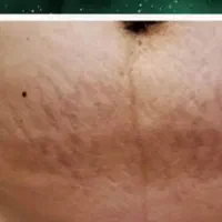 فقط قبل بعد درمان سخت ترین مشکلات پوستی|آرایشی، بهداشتی، درمانی|تهران, اوقاف|دیوار