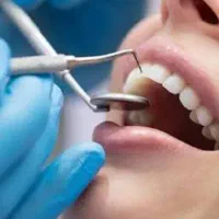 راهنمایی جذب نیرو