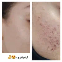 پوستی صاف وشفاف