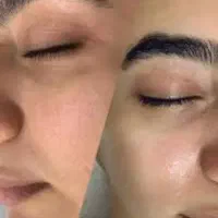 پاکسازی پوست