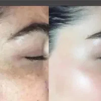 کرمهای ضدآفتاب بی رنگ و رنگی کرم ضدلک رضایت مشتری|آرایشی، بهداشتی، درمانی|لاهیجان, قیام|دیوار