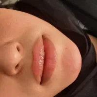 جشنواره ژل و بوتاکس و مزوتراپی لک وجوانسازی بانوان|خدمات آرایشگری و زیبایی|اصفهان, عسگریه|دیوار