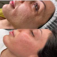 تخفیف ویژه پاکسازی پوست صدرا|خدمات آرایشگری و زیبایی|صدرا-فارس, فاز ۱|دیوار