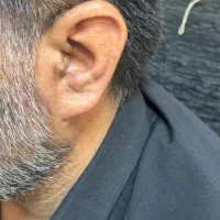 تجویز سمعک نامرئی پیشرفته (اقساط)|آرایشی، بهداشتی، درمانی|تهران, افسریه جنوبی|دیوار