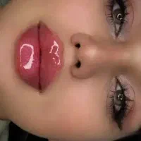 جشنواره تزریق ژل بوتاکس فیلر پی آرپی مطب زیبایی