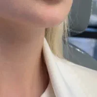 فرمول کرم سفیدکننده  معجزه
