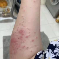 سمپاشی ساس،سوسک،کنه،مایت،موش