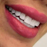 دندانپزشکی با اقساط پنچ ساله،و ارائه وام