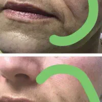 تخفیفات بلک فرایدی کرم بیوممتیک