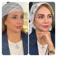 کاشت ابرو به روش میکروکاشت کلینیک مهرزاد