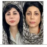 مرکز تخصصی جوانسازی اندولیفت/هایفو/لیفت فقط۸۹۰ت|خدمات آرایشگری و زیبایی|اصفهان, لاله|دیوار