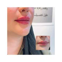 استخدام منشی و دستیار مطب پوست مو زیبایی