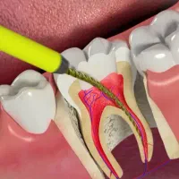 درمان و بهداشت دندان برای همه اقشار --بیمه(اقساط)|خدمات آرایشگری و زیبایی|جیرفت, |دیوار