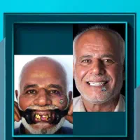 پیشنهادویژه عصبکشی دندان درپایتخت دندانپزشکی شیراز|خدمات زیبایی و سلامت|شیراز, ارم|دیوار