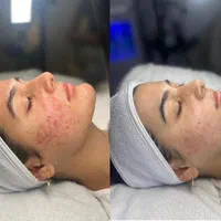 فیشال و خدمات تخصصی و درمانی پوست|خدمات آرایشگری و زیبایی|اصفهان, تخت فولاد|دیوار