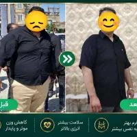 لاغری تضمینی و پزشکی در ساری(متد 2026)-دکتر پورعلی