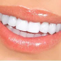 ساخت انواع دندان متحرک و ثابت