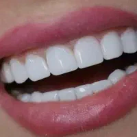 خدمات دندانی