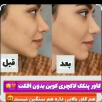 پنکک فول کاور لاکچری کوین