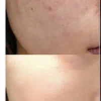 فرمول کرم سفیدکننده قوی اصل اماراتی|آرایشی، بهداشتی، درمانی|سراوان, |دیوار