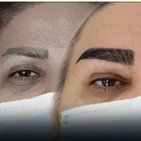 تخفیف ویژه  زمستانه عمل های  جراحی|خدمات آرایشگری و زیبایی|ارومیه, |دیوار