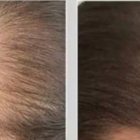 جشنواره پی ار پی صورت و مو