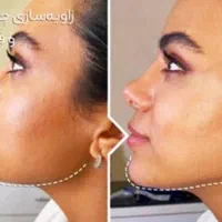 تزریق ژل و بوتاکس و فیلر بادی باتخفیف توسط پزشک|خدمات آرایشگری و زیبایی|شیراز, کلاهدوز|دیوار