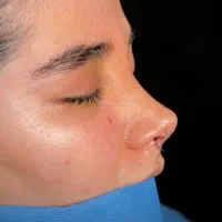 جراحی زیبایی صورت و پیکرتراشی
