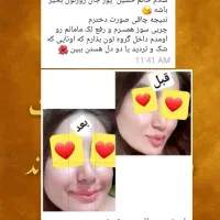 لاغری اصولی|آرایشی، بهداشتی، درمانی|کوهدشت, |دیوار