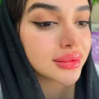 ژل بوتاکس مزو فیلر انزیم فیلر فشیال