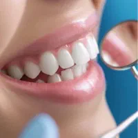 کامپوزیت دندان کامپوزیت زیبایی لمینیت دندان|خدمات آرایشگری و زیبایی|قم, قلعه یزدیها|دیوار