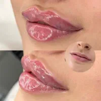 کلینیک پوست و مو|خدمات آرایشگری و زیبایی|تهران, ستارخان|دیوار