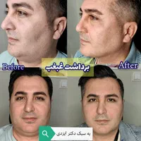 چربی بیکینی لابیا پلاستی تنگی انواع جراحی لیفت|خدمات آرایشگری و زیبایی|شیراز, شهرک گلستان|دیوار