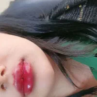 تخفیف ی ماهه تزریق ژل و بوتاکس