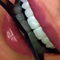 استخدام دستیار منشی دندانپزشکی خانم