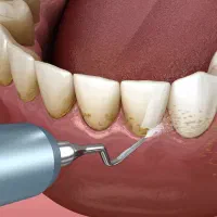 کلینیک دندانپزشکی در کیانپارس میهن شرقی|خدمات آرایشگری و زیبایی|اهواز, کیانپارس |دیوار
