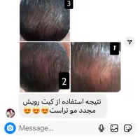 مشاوره پوست ومو|آرایشی، بهداشتی، درمانی|محمدیه-قزوین, |دیوار