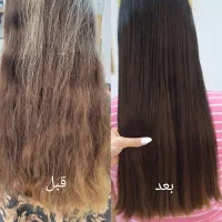 ۲۸۰ موخوره تراپی