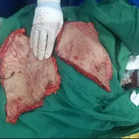 ابدو.ماموپلاستی.پیکرتراشی.براکیوپلاستی.پروتزسینه
