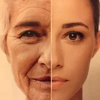 اموزش صفرتاصد عارضه های پوست|خدمات آموزشی|تهران, آهنگ|دیوار