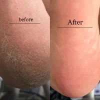 پدیکور پا|خدمات آرایشگری و زیبایی|بروجرد, |دیوار