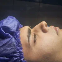 جراحی بینی توسط دکتر متخصص  امیر اسدالله پور