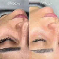 فیشال و ابرسانی فقط فقط  با ۴۹۰ تخفیف ویژه