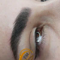 فیبروز میکروبلیدینگ شیدینگ لب خط چشم بن مژه