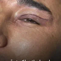 استخدام کلینیک جراحی( پرستارمشاور)