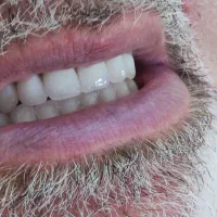 دندانسازی (فقط با ۱۵ میلیون )|خدمات آرایشگری و زیبایی|پرند, فاز ۲|دیوار