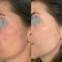 لکه برِ جهانی|آرایشی، بهداشتی، درمانی|کبودرآهنگ, |دیوار